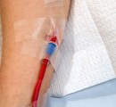 1_eboo-ozone-therapy-iv-with-purified-blood-in-patients-arm-copy
