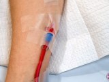 Close-up of IV line during EBOO therapy showing bright red purified blood.