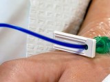 Close-up of Methylene Blue IV in Patients Arm