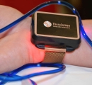 Theralumen photo-dynamic therapy light device on patient's wrist next to IV tubing filled with Methylene Blue.
