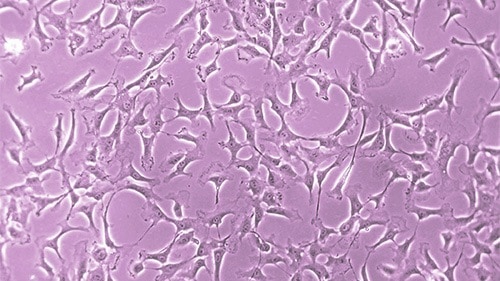 Healthy, undifferentiated stem cells under a microscope