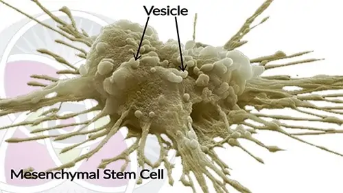 Mesenchymal stem cell 