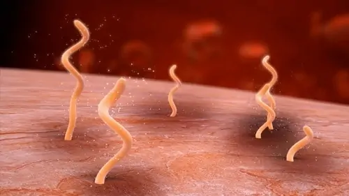 The Borrelia spirochaete can drill into your tissue and hide from antibiotics.
