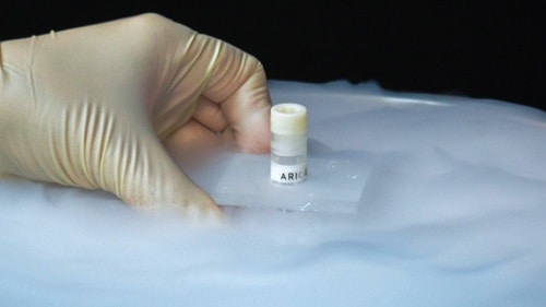 Stem cells are stored in cryogenic freezers at -80°C. In this photo a vial of stem cells is being removed from cryopreservation.