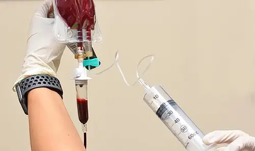 A nurse infuses an IV bag of blood with ozone.