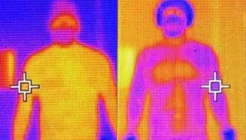Thermal camera of the skin before and after whole body.cryotherapy session.