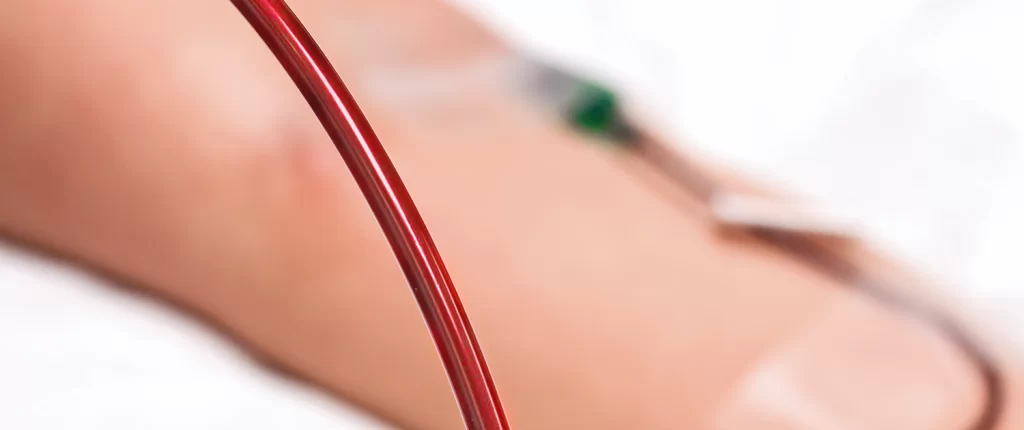Ozone Iv Therapy