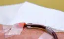 thumbs_dark-blood-removed-from-patient-by-stratos-eboo-device