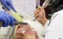 thumbs_erbium-laser-to-remove-skin-cancers