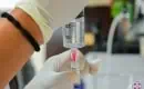 thumbs_filling-syringe-with-stem-cells