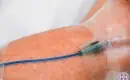 thumbs_intravenous-methylene-blue-for-long-covid-fatigue-ama-regenerative-medicine-copy