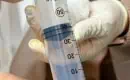 thumbs_ozone-injection-into-lower-back-ama-regenerative-medicine