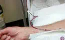 thumbs_ozone-therapy-10-pass-iv-line