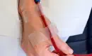 thumbs_purified-blood-from-eboo-treatment-reinfused-into-patient