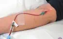 thumbs_single-dose-ozone-therapy-iv-in-patients-arm