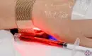 thumbs_vaccin-induced-long-covid-patient-with-red-light-therapy