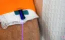 thumbs_weber-blue-low-level-intravenous-laser-therapy-ama-regen-med