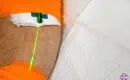 thumbs_weber-green-intravenous-laser-light-therapy-ama-regen-med