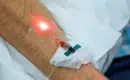 thumbs_weber-intravenous-low-level-light-laser-in-patient-arm-ama-regen-med-D