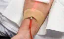 thumbs_weber-red-low-level-laser-therapy-IV-ama-regen-med-D