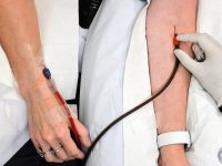 both-iv-lines-during-eboo-therapy-treatment