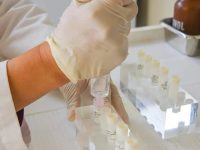 doctor-drawing-up-mesenchymal-stem-cells