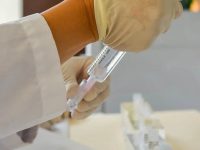 drawing-up-stem-cells-2