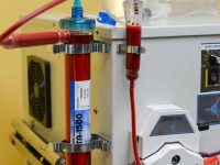 eboo-close-up-of-the-filter-and-ozonation-system-extracorporeal-oxygenation-and-ozonation-ama-regenerative-medicine