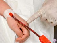 eboo-doctor-pointing-towards-debris-coming-out-of-patients-vein-ama-regenerative-medicine