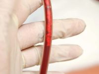 eboo-it-is-debris-like-this-that-is-captured-in-the-filter-ama-regenerative-medicine