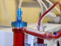 eboo-ozone-treatment