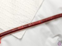 eboo-this-debris-will-be-filtered-and-removed-before-the-blood-is-returned-to-the-patient-ama-regenerative-medicine