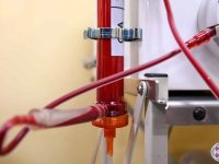 Close-up of the Stratos EBOO filter where cellular debris and micro-clots are removed from the circulating blood.
