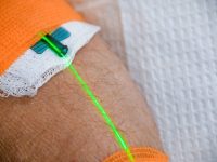 green-intravenous-laser-light-therapy-weber