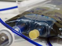 iv-bag-of-methylene-blue-ready-for-long-covid-patient