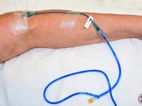 long-covid-fatigue-treatment-with-iv-methylene-blue-ama-regenerative-medicine