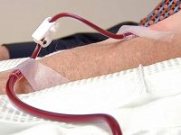 man-receiving-ozone-blood-therapy-treatment