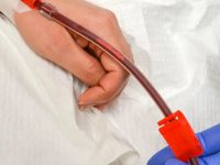 Initial phase of EBOO /F (apheresis) treatment, showing a patient's blood safely leaving the body via a sterile IV line.