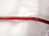 ozone-dialysis-eboo-ozone-debris-ama