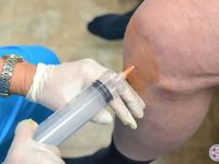 Injection of ozone therapy into the knee joint to treat arthritis and chronic joint pain.