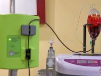 Close-up of Major Autohemotherapy (MAH) setup, showing blood being treated with ozone gas during Scot's DSAP therapy.
