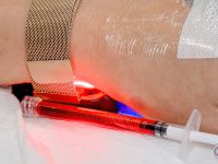 vaccin-induced-long-covid-patient-with-red-light-therapy