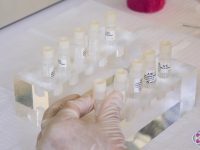 vials-of-stem-cells