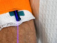 weber-blue-low-level-intravenous-laser-therapy-ama-regen-med