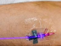 weber-blue-photobiomodulation-low-level-laser-therapy