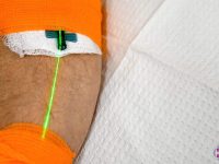 weber-green-intravenous-laser-light-therapy-ama-regen-med