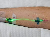 weber-green-intravenous-laser-light-therapy