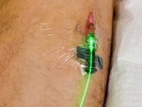 weber-green-photobiomodulation-low-level-laser-therapy