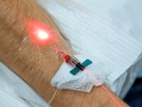 weber-intravenous-low-level-light-laser-in-patient-arm-ama-regen-med-D