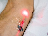 weber-intravenous-red-laser-photodynamic-therapy-ama-regen-med